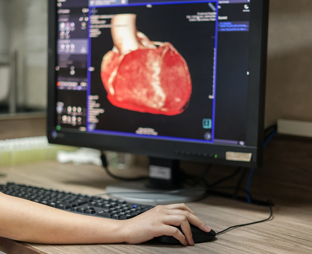 Female Technologist Viewing Cardiac CT Results On Computer Monitor